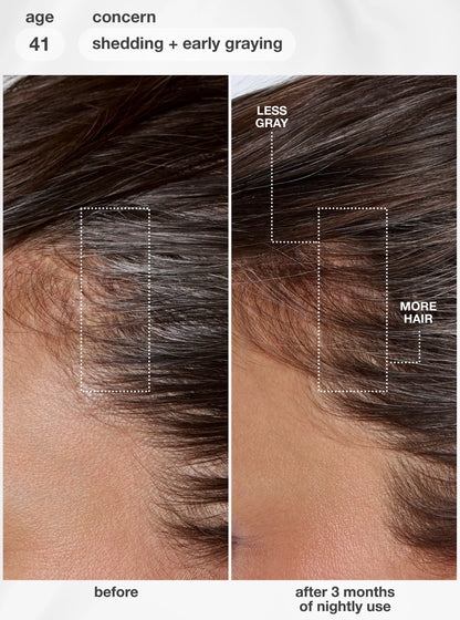 FutureIQ™ biomimetic hair longevity serum