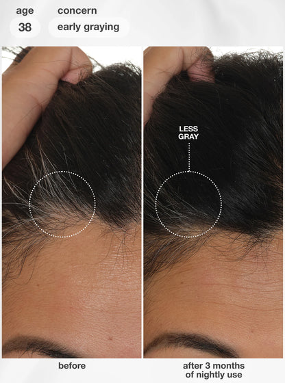 FutureIQ™ biomimetic hair longevity serum