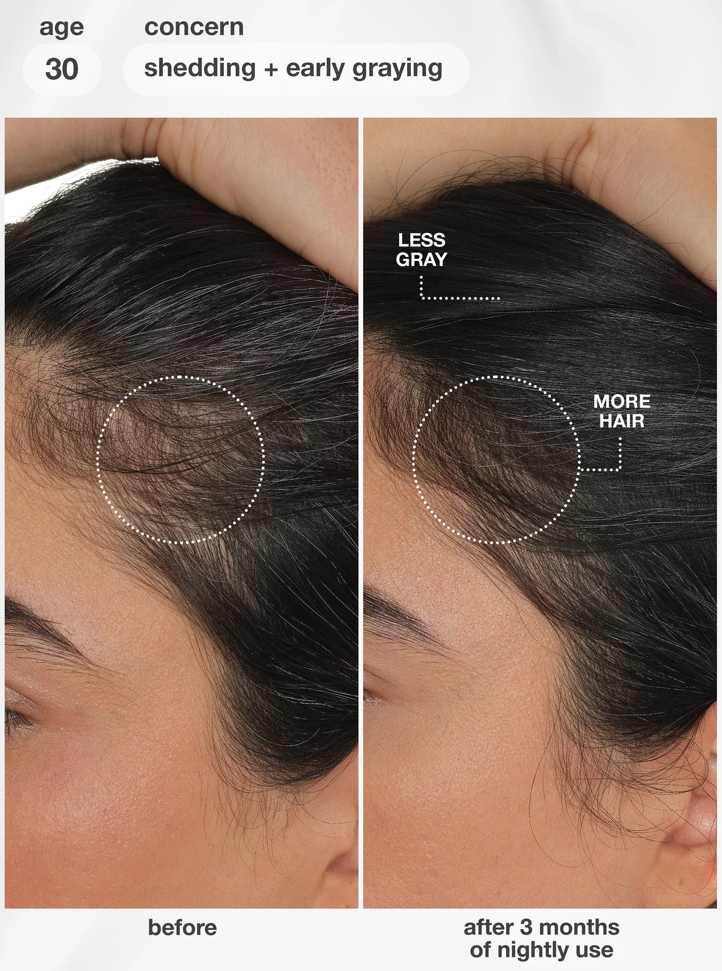 FutureIQ™ biomimetic hair longevity serum