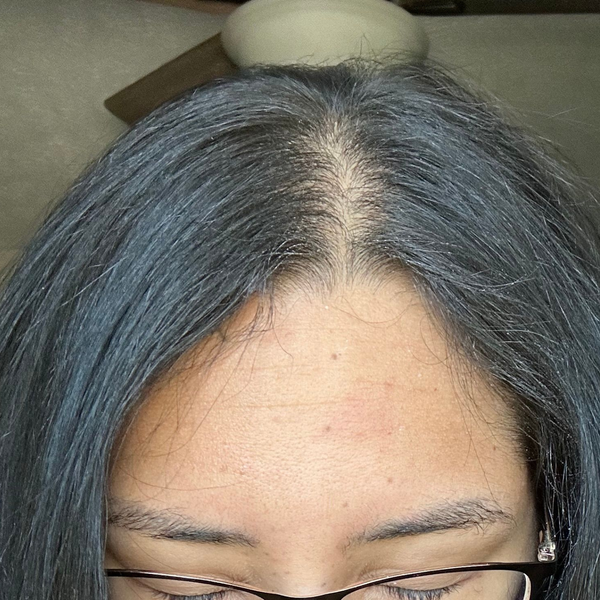 After